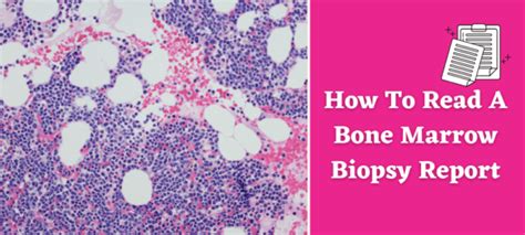 understanding bone marrow biopsy results|bone marrow biopsy patient information.